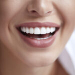 composite vs porcelain veneers